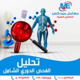 أماكن تحليل شامل في طنطا